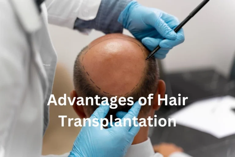 Advantages of Hair Transplantation